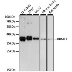 RBM11 Rabbit pAb
