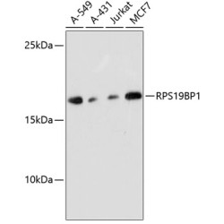 RPS19BP1 Rabbit pAb