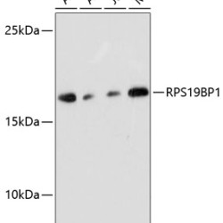 RPS19BP1 Rabbit pAb