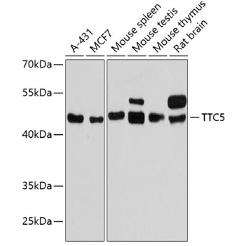 TTC5 Rabbit pAb