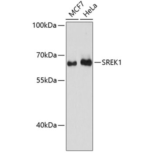 SREK1 Rabbit pAb