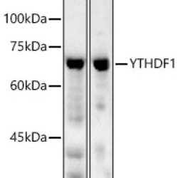 YTHDF1 Rabbit pAb