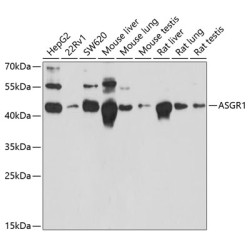 ASGR1 Rabbit pAb