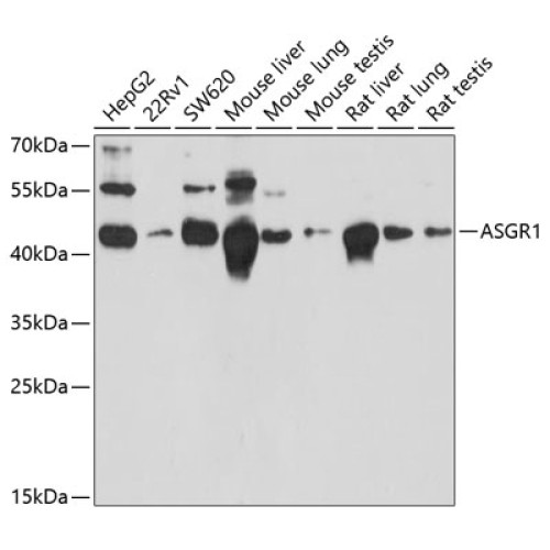 ASGR1 Rabbit pAb
