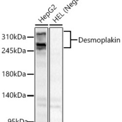 Desmoplakin Rabbit pAb