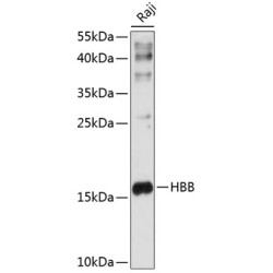 HBB Rabbit pAb