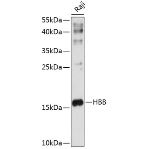 HBB Rabbit pAb