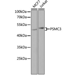 PSMC3 Rabbit pAb