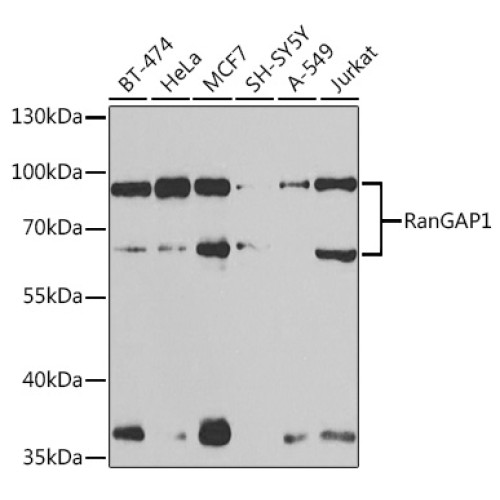 RanGAP1 Rabbit pAb