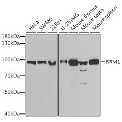 RRM1 Rabbit pAb