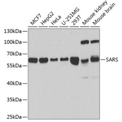 SARS Rabbit pAb