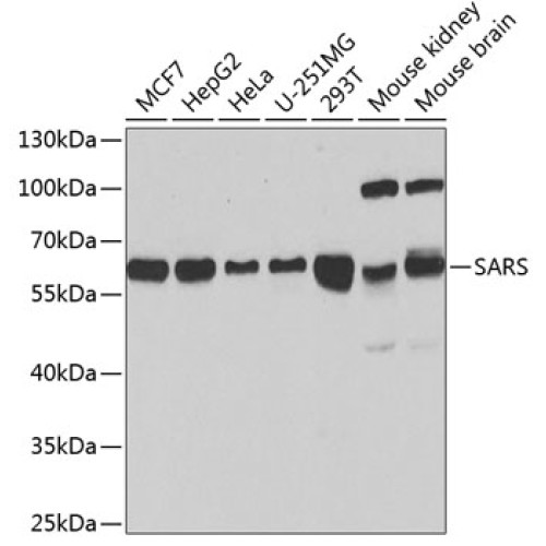 SARS Rabbit pAb