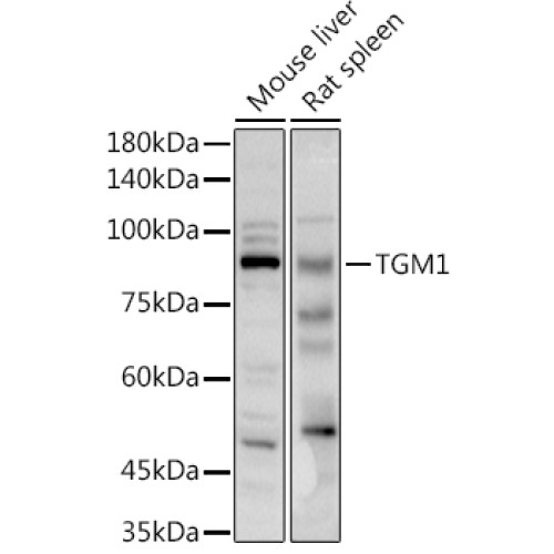 TGM1 Rabbit pAb
