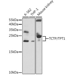 TCTP/TPT1 Rabbit pAb