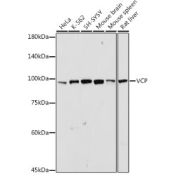 VCP Rabbit pAb