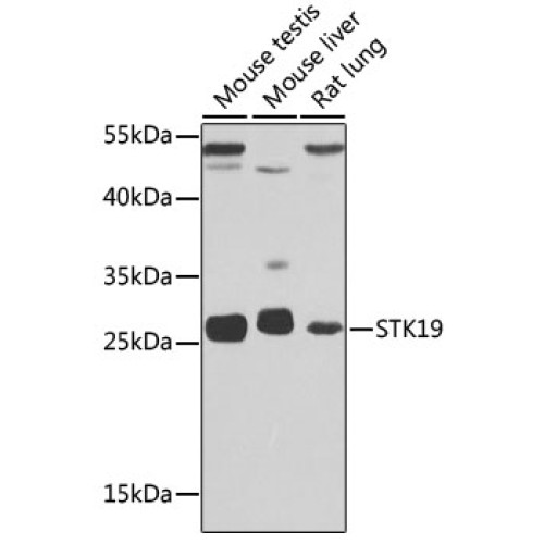 STK19 Rabbit pAb