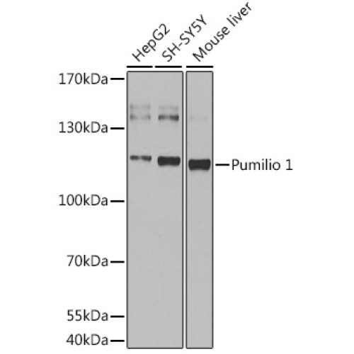 Pumilio 1 Rabbit pAb