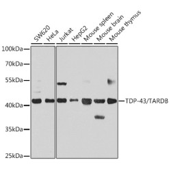 TDP-43/TARDBP Rabbit pAb