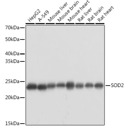 [KO Validated] SOD2 Rabbit pAb
