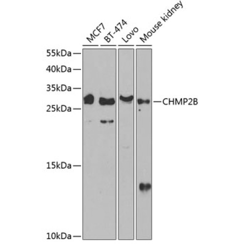 CHMP2B Rabbit pAb