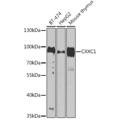 CXXC1 Rabbit pAb