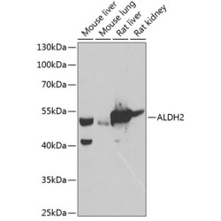 ALDH2 Rabbit pAb