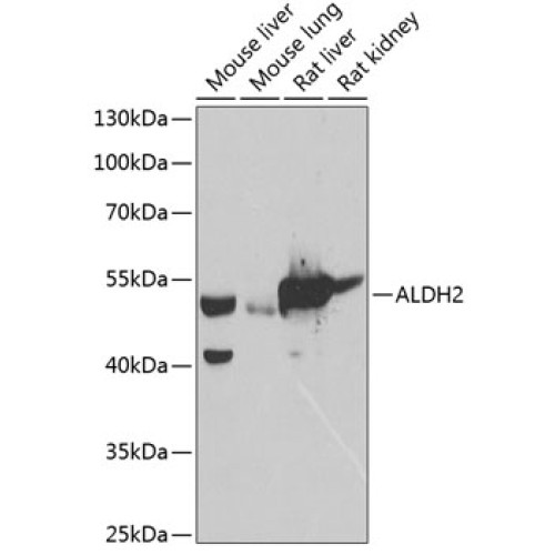 ALDH2 Rabbit pAb