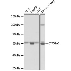 CYP51A1 Rabbit pAb