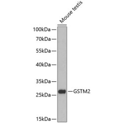 GSTM2 Rabbit pAb