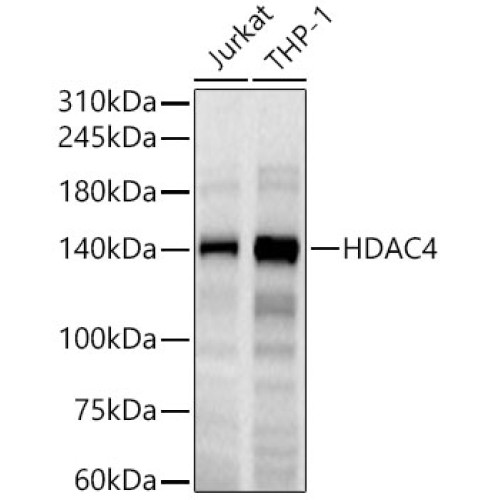 HDAC4 Rabbit mAb