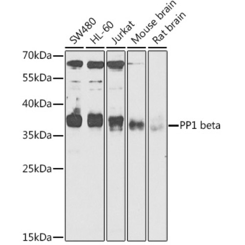 PP1 beta Rabbit pAb