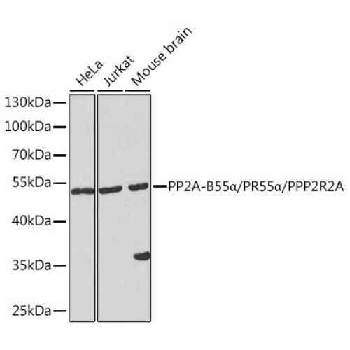 PP2A-B55α/PR55α/PPP2R2A Rabbit pAb