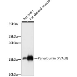 Parvalbumin/PVALB Rabbit pAb