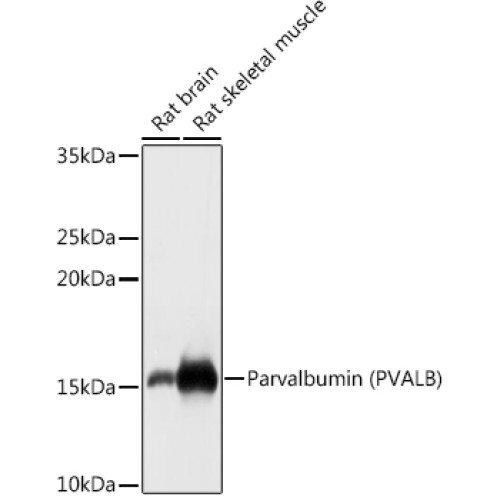Parvalbumin/PVALB Rabbit pAb