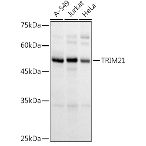TRIM21/SS-A Rabbit pAb