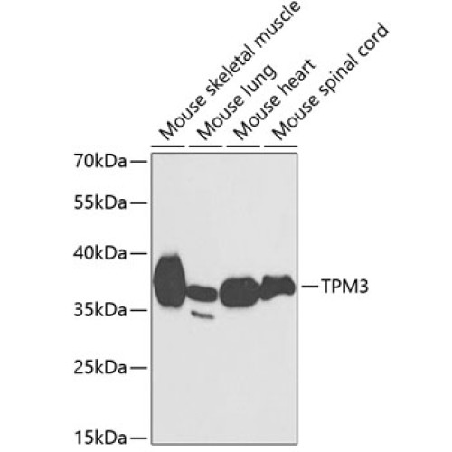 TPM3 Rabbit pAb