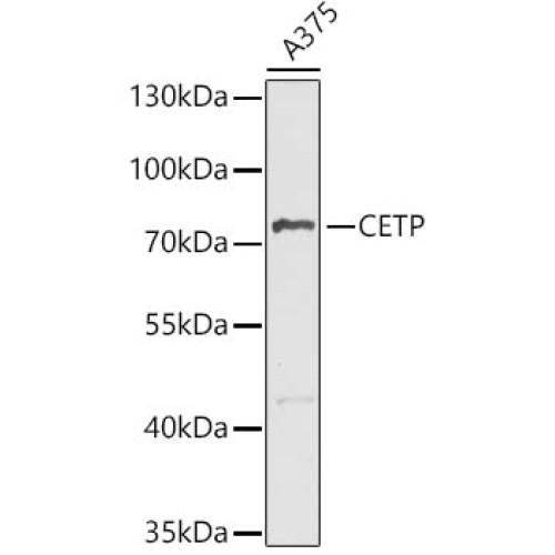 CETP Rabbit pAb