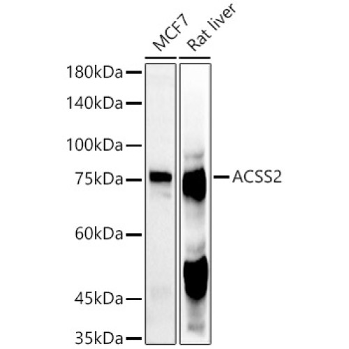 ACSS2 Rabbit pAb