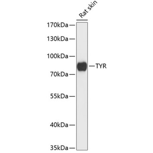 Tyrosinase Rabbit pAb