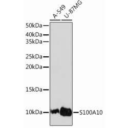 S100A10 Rabbit mAb