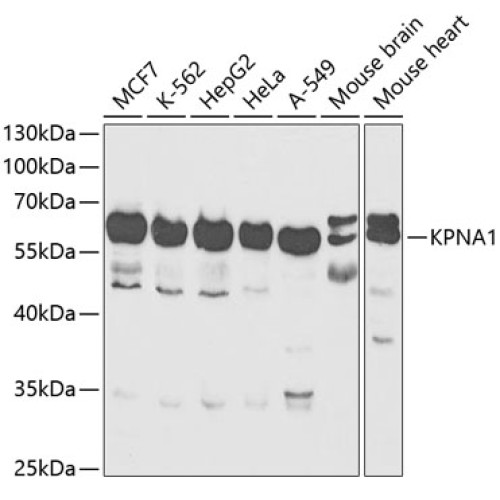 KPNA1 Rabbit pAb