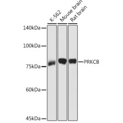 PKC-beta Rabbit pAb