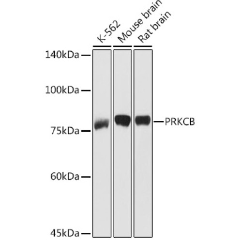 PKC-beta Rabbit pAb
