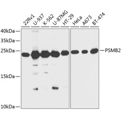 PSMB2 Rabbit pAb