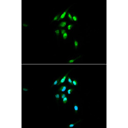 Glucocorticoid Receptor Rabbit pAb