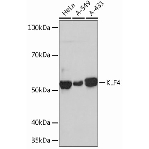 KLF4 Rabbit mAb