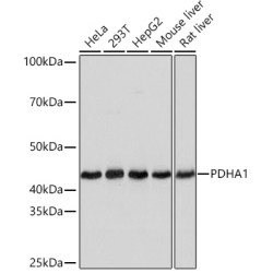 PDHA1 Rabbit mAb