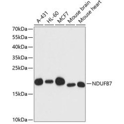 NDUFB7 Rabbit pAb