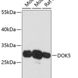 DOK5 Rabbit pAb