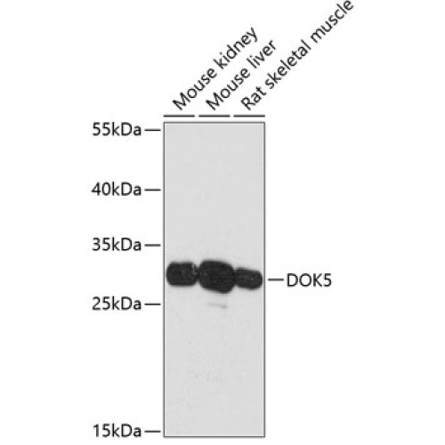 DOK5 Rabbit pAb